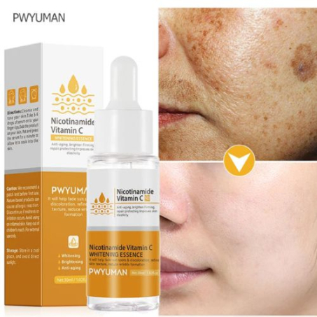Nicotinamide Whitening Freckles Serum Dark Spot Remover Vitamin C In Pakistan