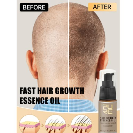 PURC Hair Growth Oil for Men Women Anti Hair Loss In Pakistan