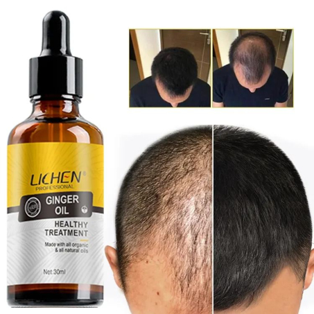 Lichen Professional Ginger Hair Serum Price In Pakistan