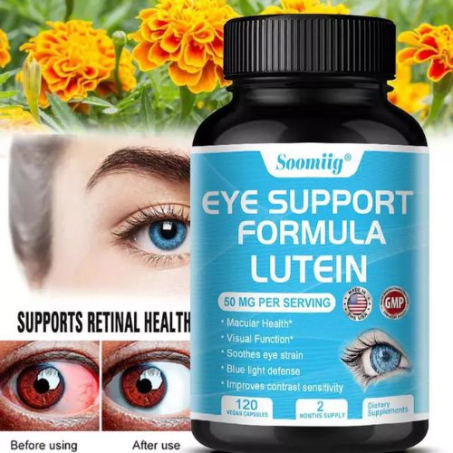 Eye Support Supplement Vision In Pakistan